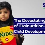 effects of malnutrition on child development