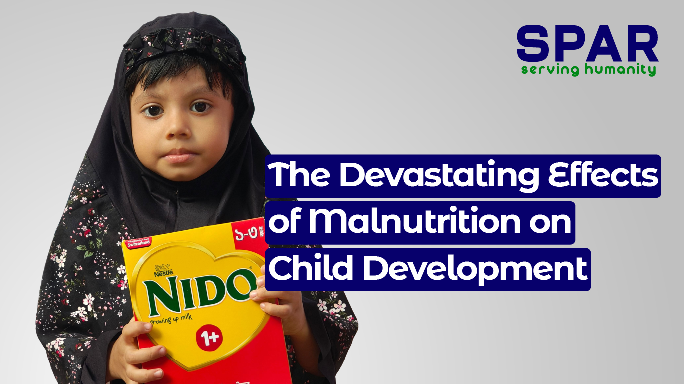 effects of malnutrition on child development